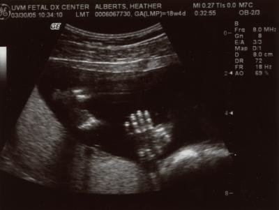 Hand