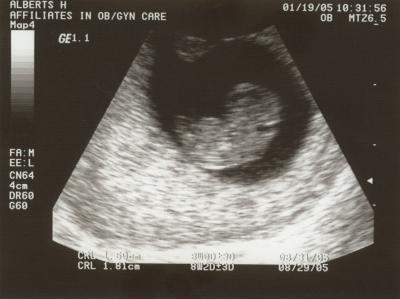 First Picture - 8 weeks