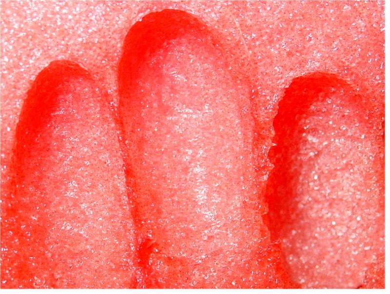 bloody  fingers? by florg