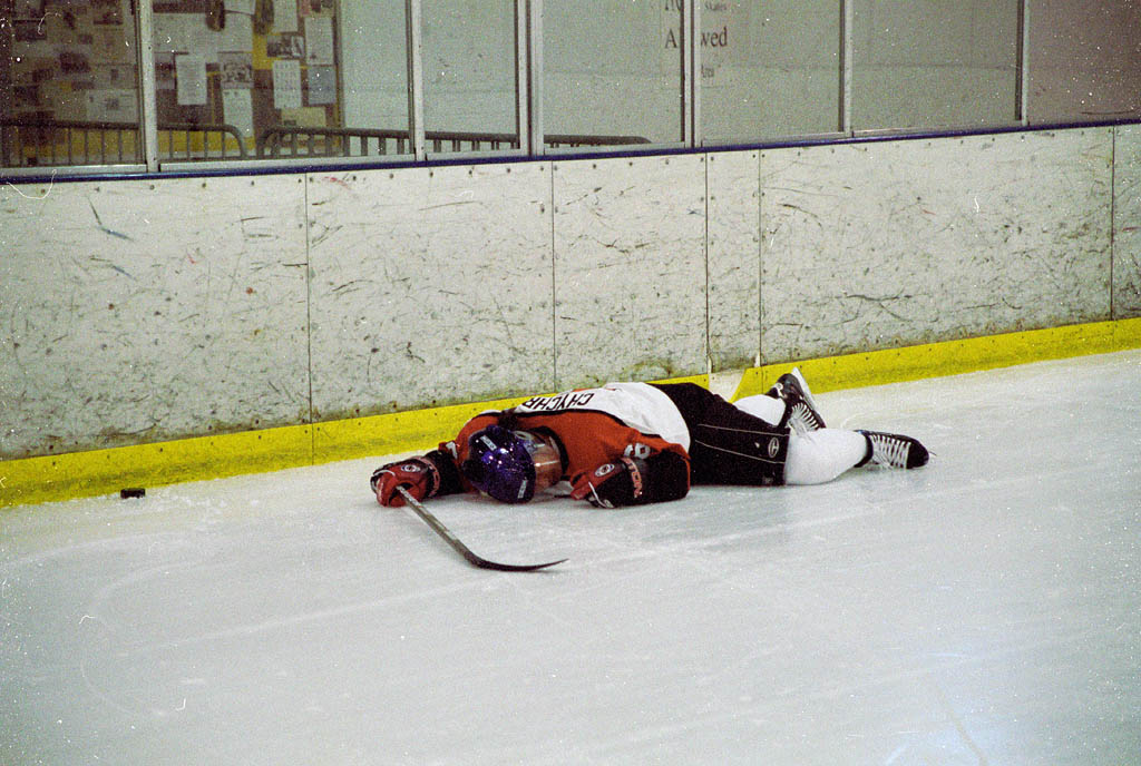 I twisted my knee