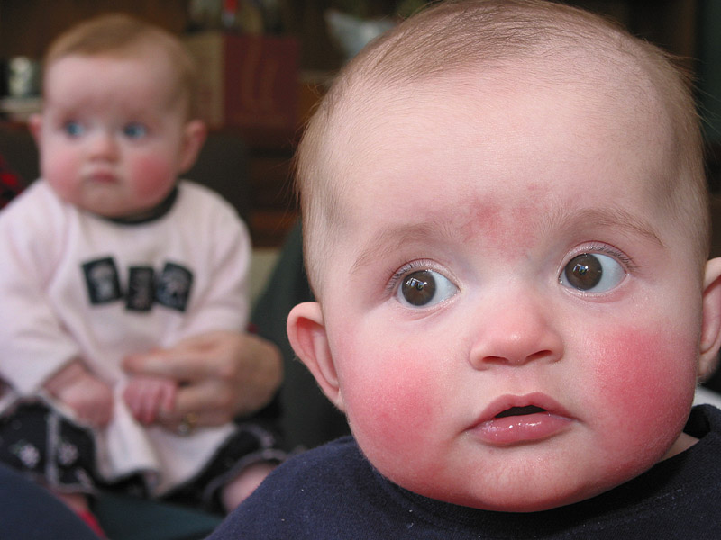 molly and lachlan