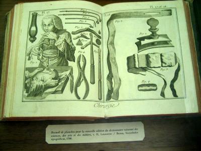 antique book display, trepanation (regional museum)