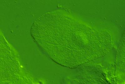 Buccal epithelial cell (human - mine) 63X plan APO- 1.4x teleconverter