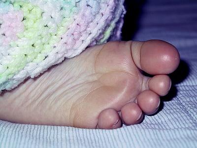 Sleeping Foot