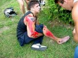 Road Rash - Hurts doesnt it?