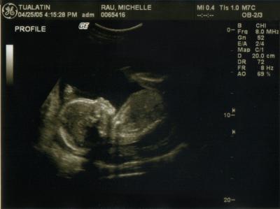 Keeley (21 weeks).jpg
