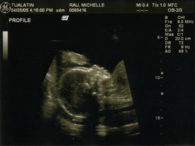 Keeley (21 weeks)1.jpg