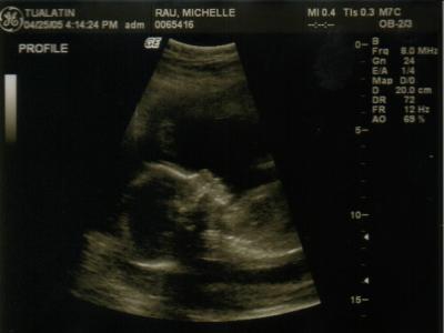 Keeley (21 weeks)2.jpg