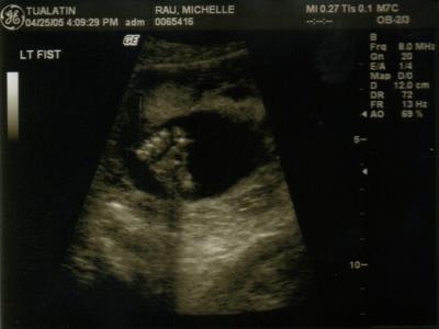 Keeley (21 weeks)3.jpg