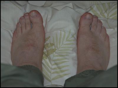 Pampered Feet