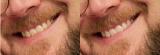 teeth.jpg