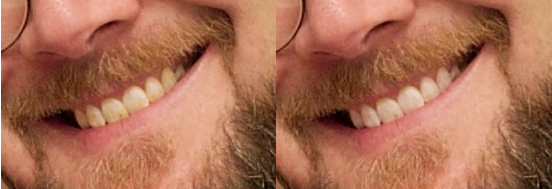 teeth.jpg