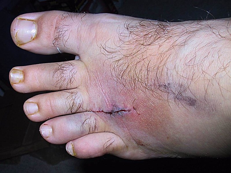 Ouch