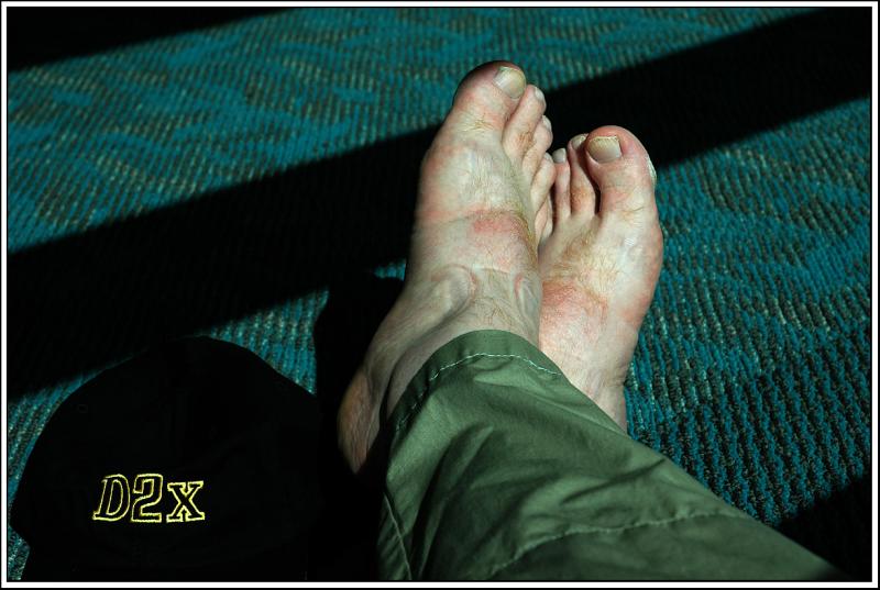 Did I? Feet