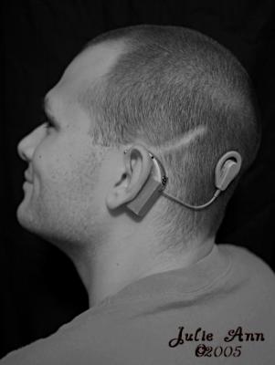 Cochlear Implant5/07/05