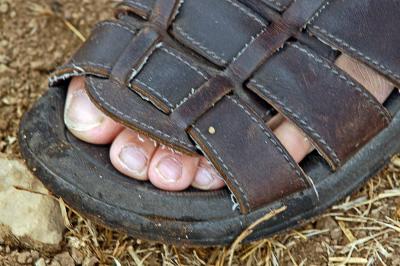 Sandal Toes