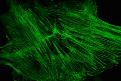 Mouse fibroblasts, stained for actin with BODIPY phallacidin, Zeiss 63X planAPO, 1.4 teleconverter