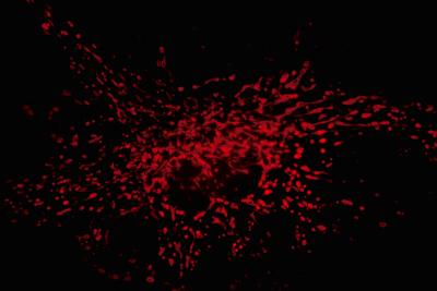 Mouse fibroblasts, stained with MitoTracker RED for mitochondria, Zeiss 63X planAPO, 1.4x teleconverter.