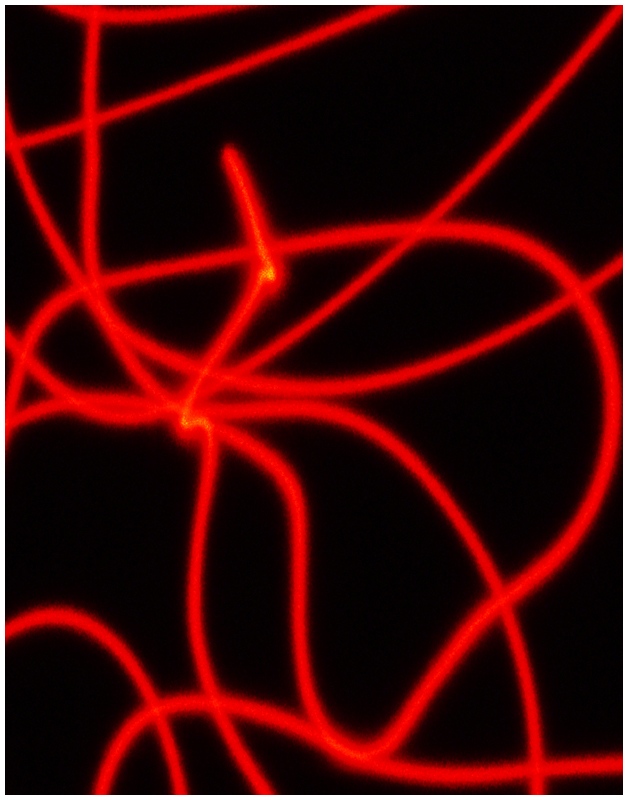 <B>Laser Veins</B><BR><font size=1>by David Cappello</font>