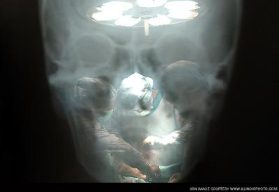 performing surgery on an Indonesian patient