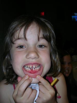 Now, She's Lost Her First Tooth
