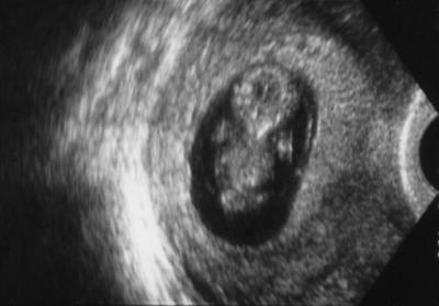 First image