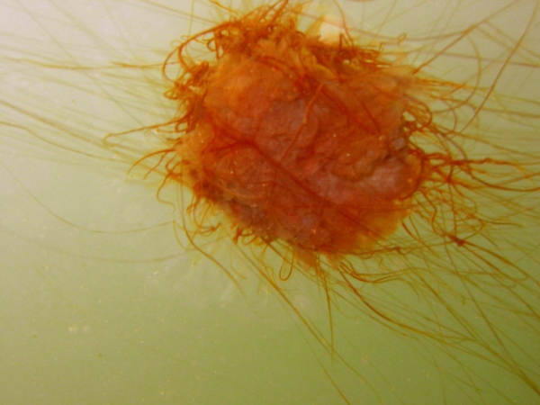 Lions Mane Jellyfish