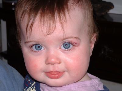 Our Black eyed baby