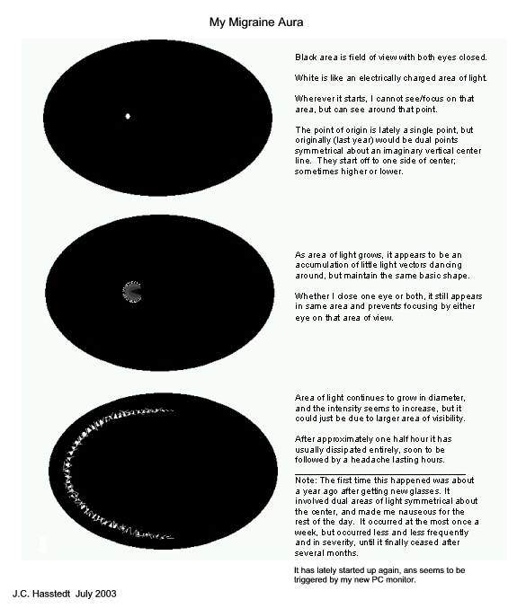 migraine with aura definition migraine with aura definition