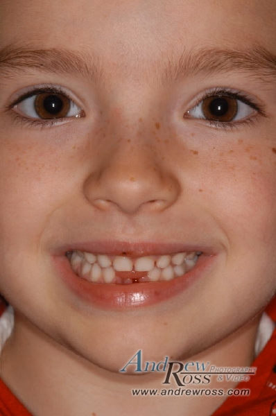 samanthas tooth08.jpg