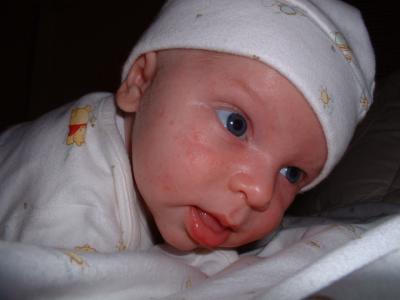 Max on his belly June 13.jpg