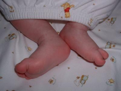 Max's feet June 13.jpg