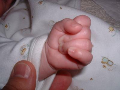Max's left hand June 13.jpg