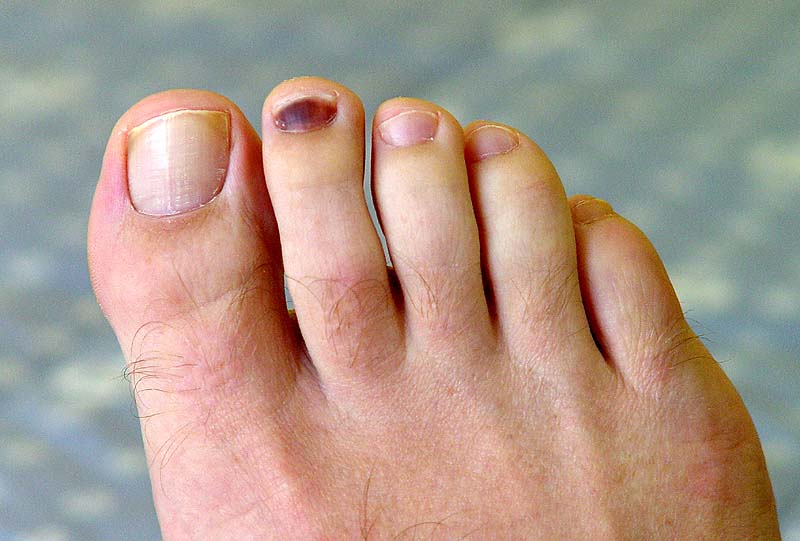 composite toe runners