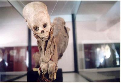 Mummy with deformed skull in the local museum of Huaytar