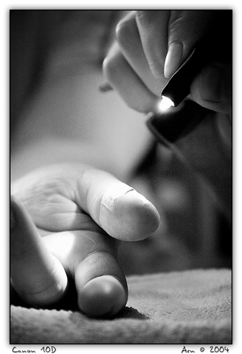 small surgery