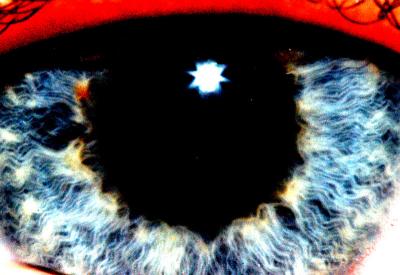 7th July - Eye