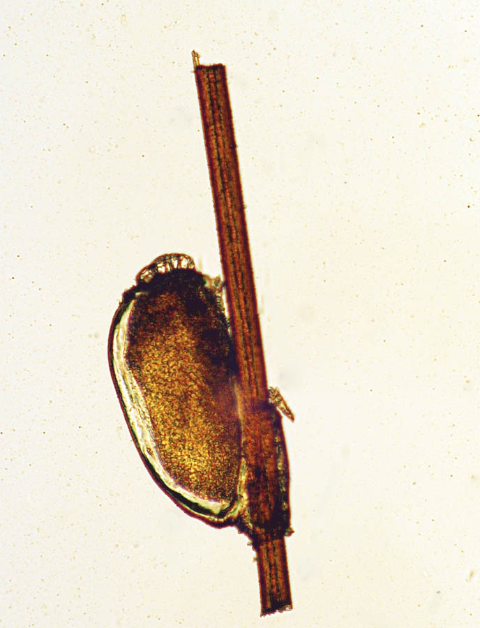 Pediculus-capitis-egg.jpg