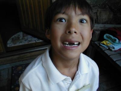 Ben without his front teeth!