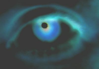 Eye