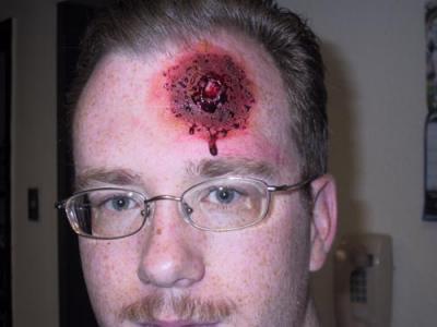 Jeff's bullet wound.jpg
