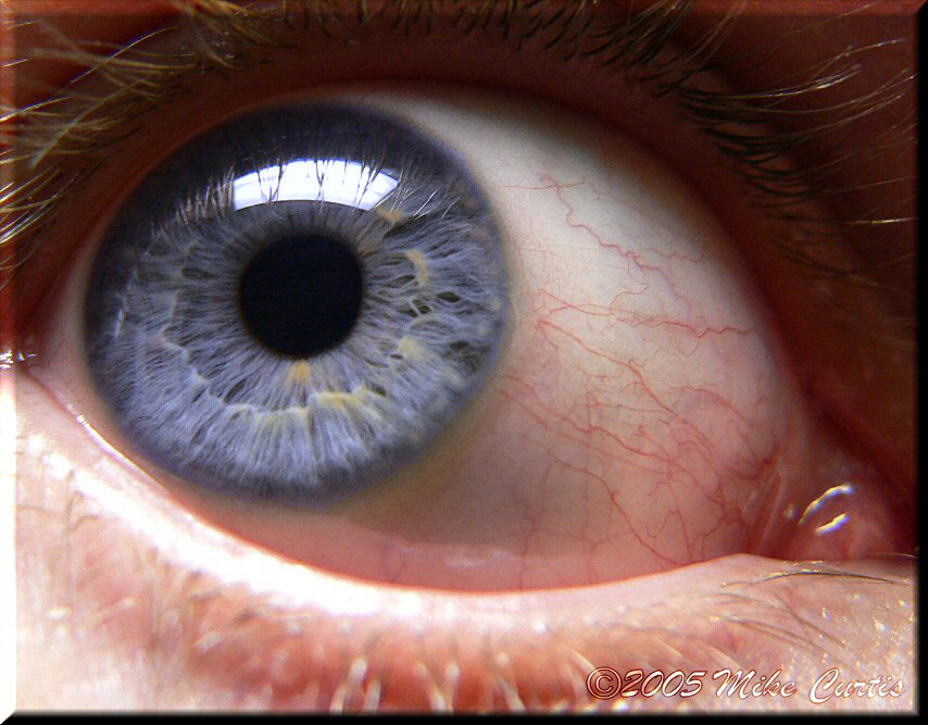 Eye Macro   (Multi POTD Winner)