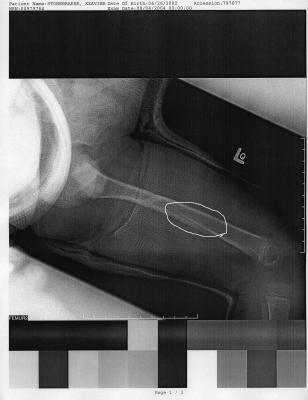 x-ray after 2 weeks