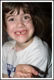 <b>First Lost Tooth*</b><br><i>by Paul Stuckless</i>
