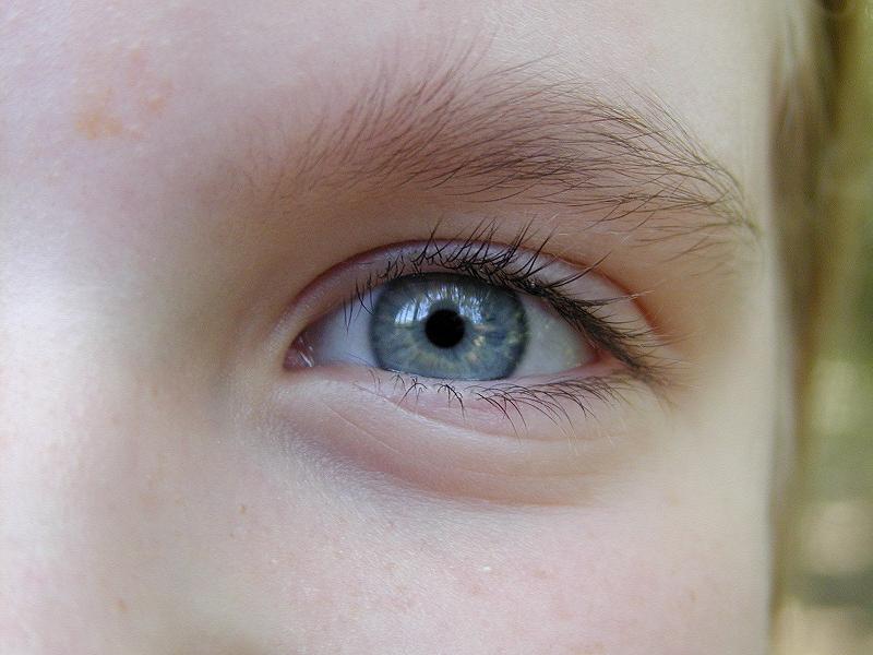 Eye