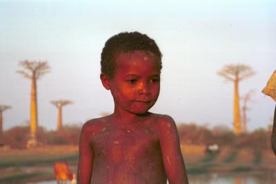 Little boy and baobabs