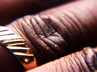 D-Lemma wrinkles2