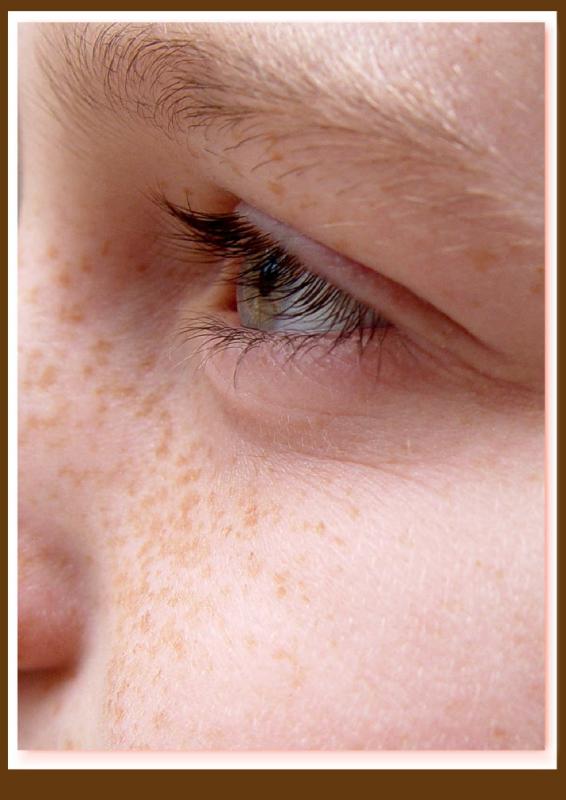 freckles*   by Carrie