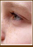 freckles*   by Carrie