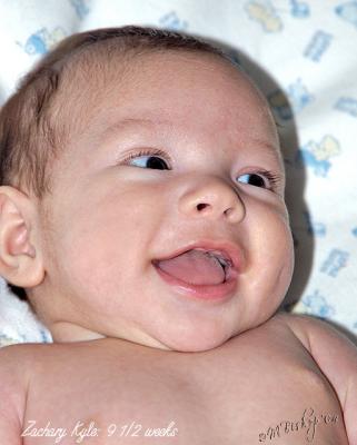 Big-Smile-9-wks.jpg